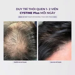 Viên Uống Cystine Plus 60 Viên Hỗ Trợ Ngăn Ngừa Rụng Tóc và Đẹp Da [hàng nhập khẩu]