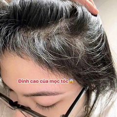 (HÀNG CHÍNH HÃNG MỸ) VIÊN UỐNG BIOTIN NATROL 10,000MCG – ĐẸP DA, KHỎE TÓC & MÓNG 100 viên
