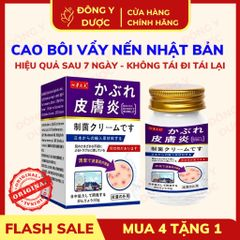 Kem Bôi Da Liễu Nakusa Nhật Bản 55G 796696
