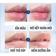 Dưỡng môi Vaseline Lip Therapy chứa Dulcis Oil - Dầu hạnh nhân - giúp giữ ẩm cho môi, chống nứt nẻ 796804