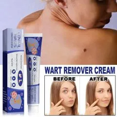 Kem Bôi Rụng Mụn Thịt Thừa & Mụn Cóc 20g 796967