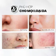 Sữa Rửa Mặt Mandelic 5% Dạng Gel Sạch Sâu Và Tẩy Tế Bào Chết MD CARE Professional 200ml