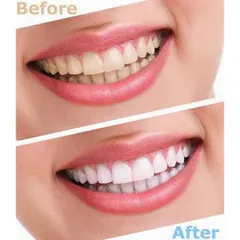 ( MẪU MỚI 147GR )  KEM ĐÁNH RĂNG CREST 3D WHITE ADVANCED TRIPLE WHITENING   NỘI ĐỊA MỸ