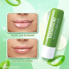 [ DATE 05.2026 ] Son Dưỡng Môi Dạng Thỏi Vaseline Lip Therapy 4.8g HƯƠNG LÔ HỘI