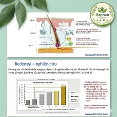 Redenlyl Lotion - Xịt dưỡng tóc , chống rụng tóc, kích thích mọc tóc