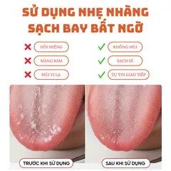 Bàn cạo lưỡi HARIKA - Dụng cụ cạo lưỡi vệ sinh răng miệng silicon - Sản phẩm vệ sinh răng miệng hàng Việt Nam.