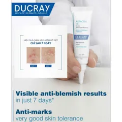 Kem Dưỡng Giảm Mụn, Mờ Thâm, Kiểm Soát Dầu Ducray Keracnyl PP+ 30ml