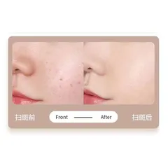 Máy Đốt Nốt Ruồi Mụn Thịt | Tàn Nhang 9 Cấp Độ Máy Đốt Nốt Ruồi Mini.