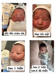 (HÀNG CHÍNH HÃNG MỸ) KEM BÔI CHÀM AVEENO BABY ACZEMA THERAPY 206g