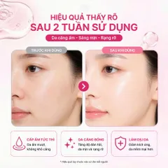 Mặt Nạ Thạch IMU Deep Collagen Jelly Pack Cấp Ẩm, Phục Hồi, Dưỡng Sáng, Ngừa Lão Hóa Mờ Nhăn 34g