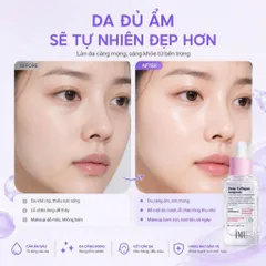 Tinh Chất Serum Phục Hồi IMU Deep Collagen Ampoule Cấp Ẩm Sâu Đa Tầng & Phục Hồi Da Tổn Thương 50ml