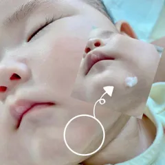 Kem phục hồi da tổn thương Sos Atono2 Hàn Quốc cho bé từ 0m+