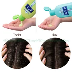 Dầu gội đầu Giảm Gàu, Mọc Tóc Lion Nhật Bản - Sach Gàu, Tóc Khỏe, Không Khô Cứng, Mùi Hương Dễ Chịu