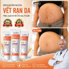 1 tuýt Kem Chống Rạn Da 40g làm mờ vết rạn dưỡng ẩm sáng da đều màu chăm sóc da săn chắc Chính Hãng