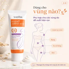 Kem xóa rạn da sau sinh mờ thâm sáng da chỉ sau 7 ngày, cải thiện sẹo rạn lâu năm, dưỡng ẩm phục hồi làn da