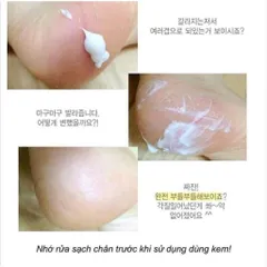 Kem nứt gót chân Hàn Quốc mềm mại da hiệu quả chất lượng