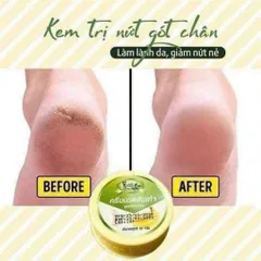 Kem giảm nứt gót chân Banana Thái 30g 807407
