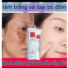 Kem bôi nám HIISEES dưỡng ẩm trắng da, mờ thâm nám, tàn nhang WHITE NING 807632