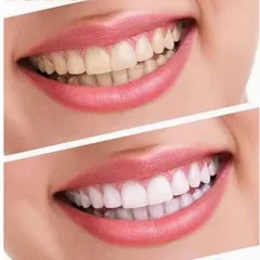 ( MẪU MỚI 147GR )  KEM ĐÁNH RĂNG CREST 3D WHITE ADVANCED TRIPLE WHITENING   NỘI ĐỊA MỸ 808468