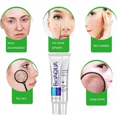 Kem hỗ trợ mụn thâm BioAqua 30ml 808679