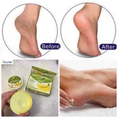 Kem trị nứt gót chân The banana Cream heels 809156