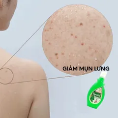 Dung dịch vệ sinh phụ nữ Gynofar (Chai 250ml) Dùng để chăm sóc vệ sinh hàng ngày.