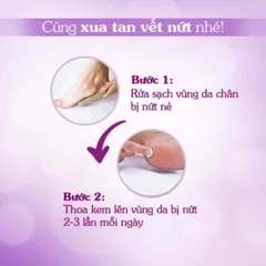 Kem dưỡng da chân FOOTGEL CLASSIC (Tuýp 50g) Hỗ trợ giảm nứt nẻ gót chân, da bàn chân, các trường hợp “nước ăn da”.