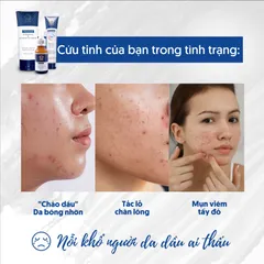 Sữa Rửa Mặt Ngừa Mụn Chuyên Biệt Cho Da Dầu C-Renew Oil Balancing Chính Hãng dạng Gel