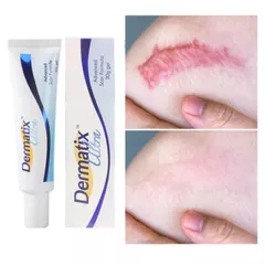 Gel làm mờ sẹo Dermatix Ultra (Tuýp 7g) Giúp làm phẳng và mờ sẹo, thẩm thấu nhanh, không cần mát xa, không nhờn dính.