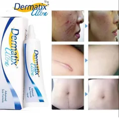 Gel làm mờ sẹo Dermatix Ultra (Tuýp 7g) Giúp làm phẳng và mờ sẹo, thẩm thấu nhanh, không cần mát xa, không nhờn dính.