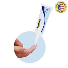 Gel làm mờ sẹo Dermatix Ultra (Tuýp 7g) Giúp làm phẳng và mờ sẹo, thẩm thấu nhanh, không cần mát xa, không nhờn dính.