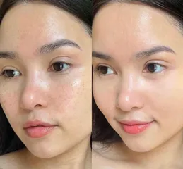 Kem Dưỡng Tía Tô Mommy Care Rebom 80gr - Giảm Nám & Dưỡng Sáng Da Tự Nhiên, Phù Hợp Mọi Loại Da Voucher Extra Chiaki Siêu RẻKem Dưỡng Tía Tô Mommy Care Rebom 80gr - Giảm Nám & Dưỡng Sáng Da Tự Nhiên, 
