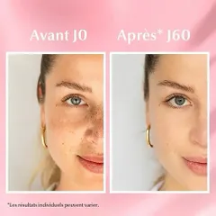 Serum Eucerin Spotless Brightening Booster Serum Thiamidol Mờ Thâm Nám Chính Hãng