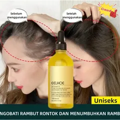 Serum mọc tóc tinh dầu mọc tóc Tinh chất mọc tóc Tinh Chất Chống Rụng Tóc Kích thích tóc mọc nhanh và giảm rụng tóc