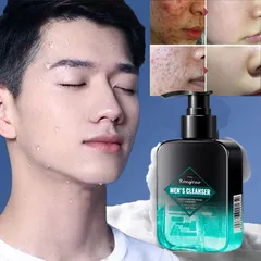 Sữa rửa mặt 160g Kiểm soát dầu giữ ẩm Men làm sạch sâu lỗ chân lông, Ngừa Mụn, Làm Trắng Da