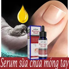 Tinh chất nấm móng Serum Tẩy Nấm Móng Tay Chân Loại Bỏ Nấm Móng Dưỡng Móng Phục Hồi Móng