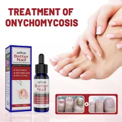 Tinh chất nấm móng Serum Tẩy Nấm Móng Tay Chân Loại Bỏ Nấm Móng Dưỡng Móng Phục Hồi Móng