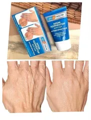 Kem Dưỡng Day Tay Mờ Thâm Kpem Apteka Nga 100ml - Phục Hồi, Dưỡng Ẩm Tối Ưu