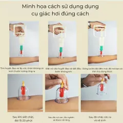 Bộ Giác Hơi Chân Không 32 Ly,24 Ly, 12 Ly Bộ Giác Hơi Không Dùng Lửa Loại Cốc Dày Hàng Cao Cấp