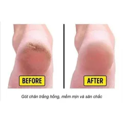 Kem bôi nứt gót chân Hàn Quốc mềm mại dưỡng ẩm