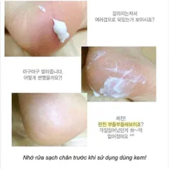 Kem bôi nứt gót chân Hàn Quốc mềm mại dưỡng ẩm
