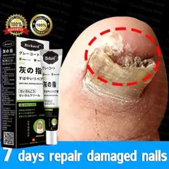 Kem bôi nấm móng tay Nhật Bản 20G