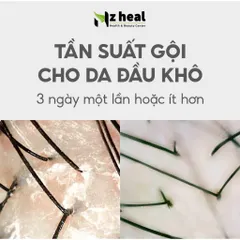 [Hỏa tốc] Dầu gội giảm gàu, giảm ngứa Aromase Dry Scalp Soothing Shampoo (90ml/ 400ml)