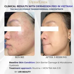 Tinh chất DermEden Mela-Protocole Hyperpigmentation TXA NIA 5.10 (5x5ml)