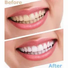 ( MẪU MỚI 147GR )  KEM ĐÁNH RĂNG CREST 3D WHITE ADVANCED TRIPLE WHITENING   NỘI ĐỊA MỸ 819093