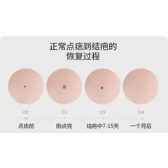 Máy Đốt Nốt Ruồi, Đốt Hôi Nách, Mụn Thịt I Máy Đốt Nốt Ruồi 9 Cấp Độ Máy Chăm Sóc Da Spa
