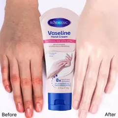 Kem Dưỡng Da Tay Vaseline 60g – Dưỡng Ẩm, Làm Trắng Da, Giúp Da Mịn Màng và Không Nứt Nẻ, Phù Hợp Mọi Loại Da 820799
