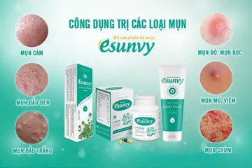 Esunvy t 25g hộp 1 tube ngăn ngừa các loại mụn: mụn trứng cá, mụn viêm, mụn cám, mụn đầu trắng, mụn đầu đen, mụn mủ, mụn bọc.