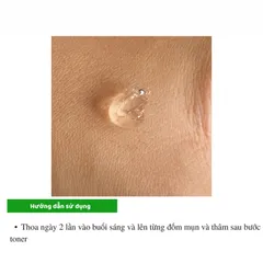 Kem Giảm Mụn Ngừa Thâm An Toàn Cho Da Actidem Derma Gel 18g
