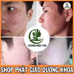 Serum tái tạo da CAO CẤP VƯƠNG MỘC TRÀ chai 30ml chuyên mụn, nám, tàn nhang, sẹo nhanh bong TẶNG BỘT
